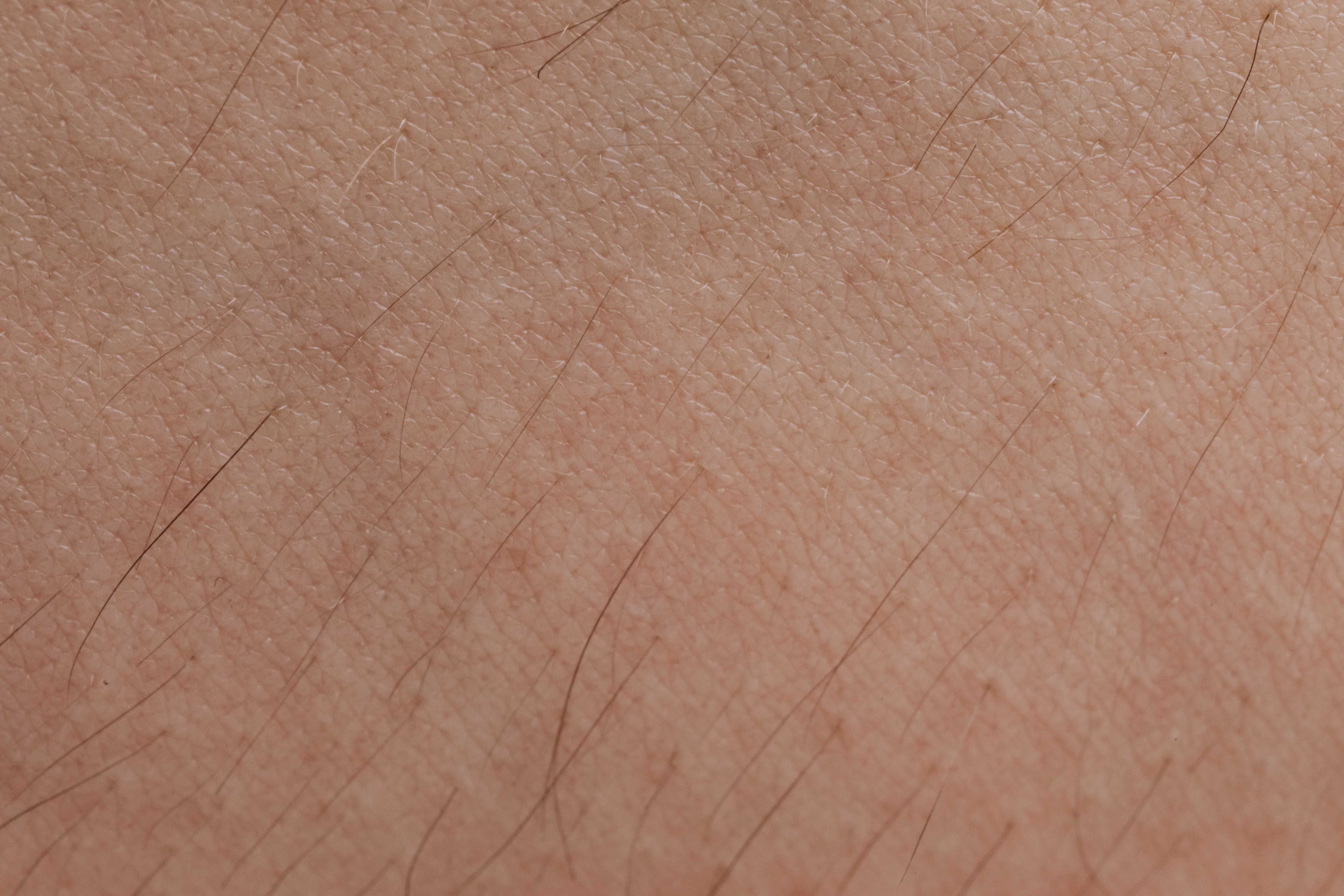 Hautoberfl&auml;che in Nahaufnahme mit einzelnen kleinen Haaren